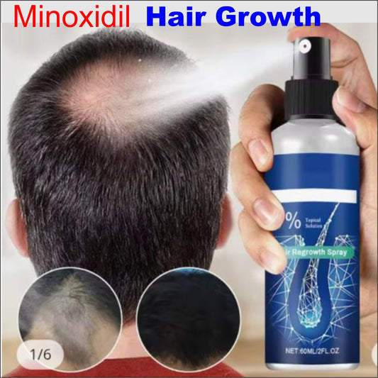 HVIQAN Top quality 6% Minoxidil Hair growth Oil  - Hair Treatment, Beard And Hair Growth for men and women